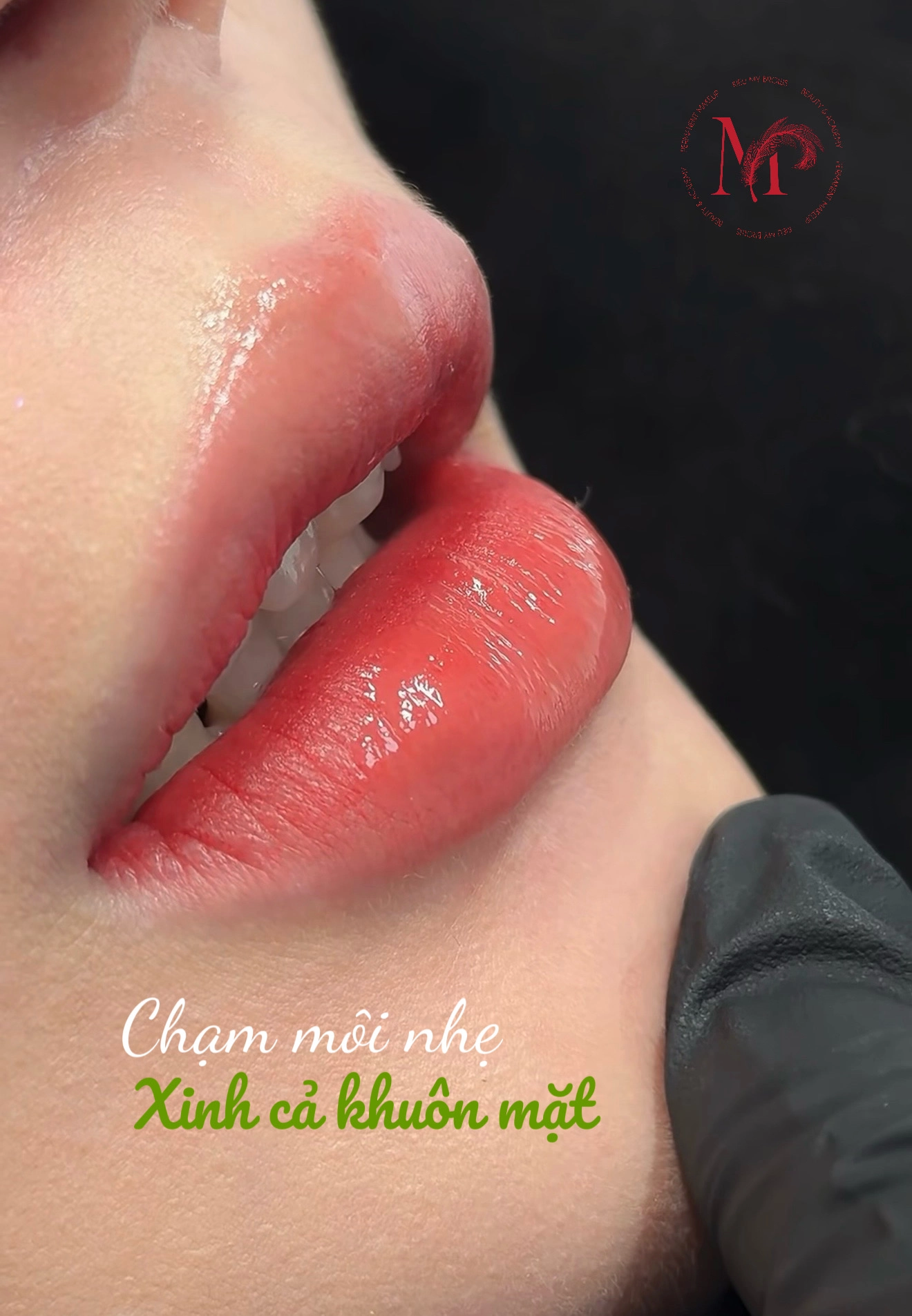 Thẩm mỹ môi Kieu My Brows