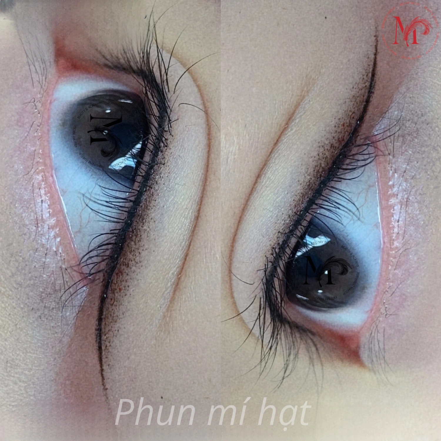 Thẩm mỹ mí mắt Kieu My Brows