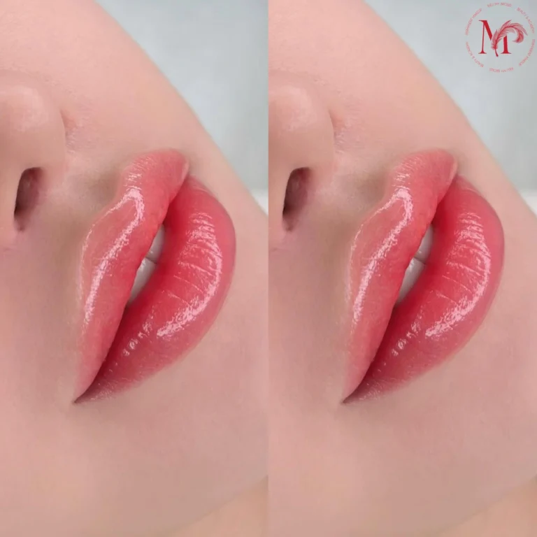 Video Thẩm mỹ môi - Kieu My Brows